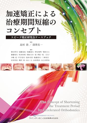 加速矯正による治療期間短縮のコンセプト: スピード矯正研究会ケース